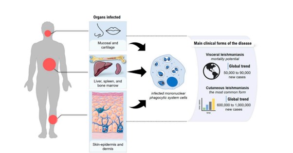 Jenis infeksi Leishmania